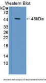 Hemoglobin Delta (HBd) Antibody