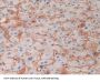 Hemoglobin Delta (HBd) Antibody