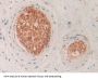 Hemoglobin Delta (HBd) Antibody