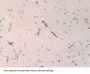 Hemoglobin Delta (HBd) Antibody