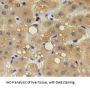 Interleukin 17 Receptor B (IL17RB) Antibody
