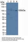Iron Responsive Element Binding Protein 2 (IREB2) Antibody