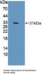 Iron Responsive Element Binding Protein 2 (IREB2) Antibody