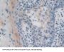 Iron Responsive Element Binding Protein 2 (IREB2) Antibody