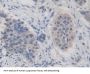 Iron Responsive Element Binding Protein 2 (IREB2) Antibody