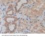 Iron Responsive Element Binding Protein 2 (IREB2) Antibody