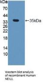 Nei Endonuclease VIII Like Protein 1 (NEIL1) Antibody