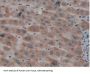 Nei Endonuclease VIII Like Protein 1 (NEIL1) Antibody