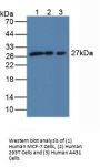 SCO Cytochrome Oxidase Deficient Homolog 2 (SCO2) Antibody