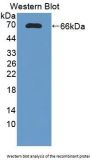 Tumor Necrosis Factor Receptor Superfamily Member 10C (TNFRSF10C) Antibody