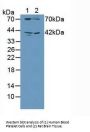 Guanylate Cyclase 1 Beta 3 (GUCY1b3) Antibody