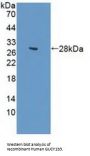 Guanylate Cyclase 1 Beta 3 (GUCY1b3) Antibody