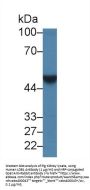 LIM Domain Binding Protein 1 (LDB1) Antibody
