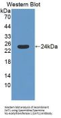 Spermidine/Spermine N1-Acetyltransferase 1 (SAT1) Antibody