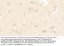 Spermidine/Spermine N1-Acetyltransferase 1 (SAT1) Antibody