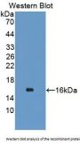 Tetraspanin 1 (TSPAN1) Antibody