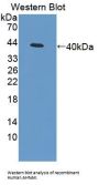 Desmoyokin (AHNAK) Antibody
