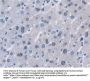 Desmoyokin (AHNAK) Antibody