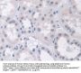 Desmoyokin (AHNAK) Antibody
