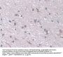Desmoyokin (AHNAK) Antibody