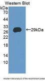 Cysteine Rich Secretory Protein 3 (CRISP3) Antibody