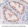 Na-K-Cl Cotransporter 2 (NKCC2) Antibody