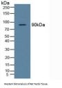 TANK Binding Kinase 1 (TBK1) Antibody