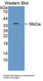 Transketolase Antibody