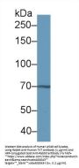 Transketolase Antibody