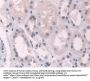 Transketolase Antibody