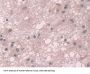 Transketolase Antibody