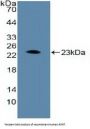 Aryl Hydrocarbon Receptor Nuclear Translocator (ARNT) Antibody