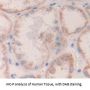 Destrin (DSTN) Antibody