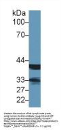 Lectin, Mannose Binding 2 (LMAN2) Antibody