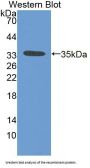 Lectin, Mannose Binding 2 (LMAN2) Antibody