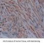 Phosphodiesterase 4D, cAMP Specific (PDE4D) Antibody