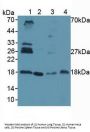 Ubiquitin Conjugating Enzyme E2I Antibody