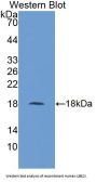 Ubiquitin Conjugating Enzyme E2I Antibody