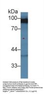 Discs, Large Homolog 3 (DLG3) Antibody