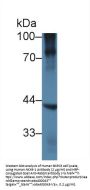 NK6 Homeobox Protein 1 (NKX6-1) Antibody