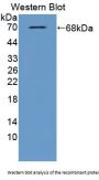 NK6 Homeobox Protein 1 (NKX6-1) Antibody