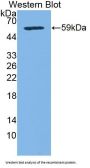 Transketolase Like Protein 1 (TKTL1) Antibody