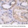 Transketolase Like Protein 1 (TKTL1) Antibody
