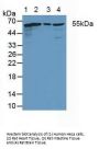 Coxsackie Virus And Adenovirus Receptor (CXADR) Antibody