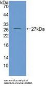 Coxsackie Virus And Adenovirus Receptor (CXADR) Antibody