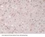 Coxsackie Virus And Adenovirus Receptor (CXADR) Antibody