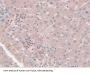 Coxsackie Virus And Adenovirus Receptor (CXADR) Antibody