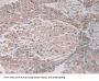 Coxsackie Virus And Adenovirus Receptor (CXADR) Antibody