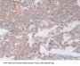 Coxsackie Virus And Adenovirus Receptor (CXADR) Antibody