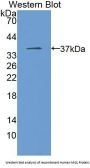 Monoglyceride Lipase (MGLL) Antibody